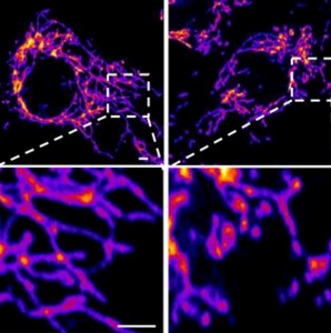The novel coronavirus&rsquo; spike protein plays additional key role in illness - Salk Institute for Biological Studies