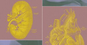 A Billionaire-Backed Startup Wants to Grow 'Organ Sacks' to Replace Animal Testing